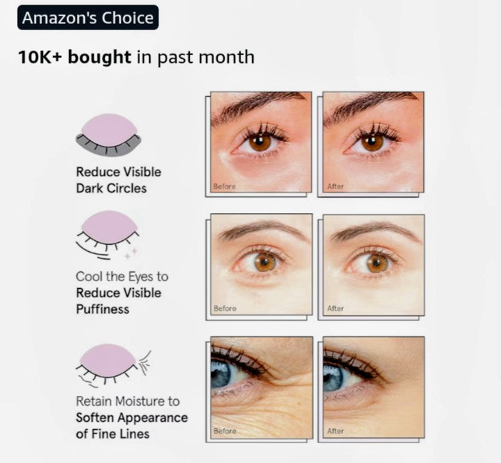 grace & stella Under Eye Patches (12 Pairs) – Eye Masks for Puffy Eyes & Dark Circles